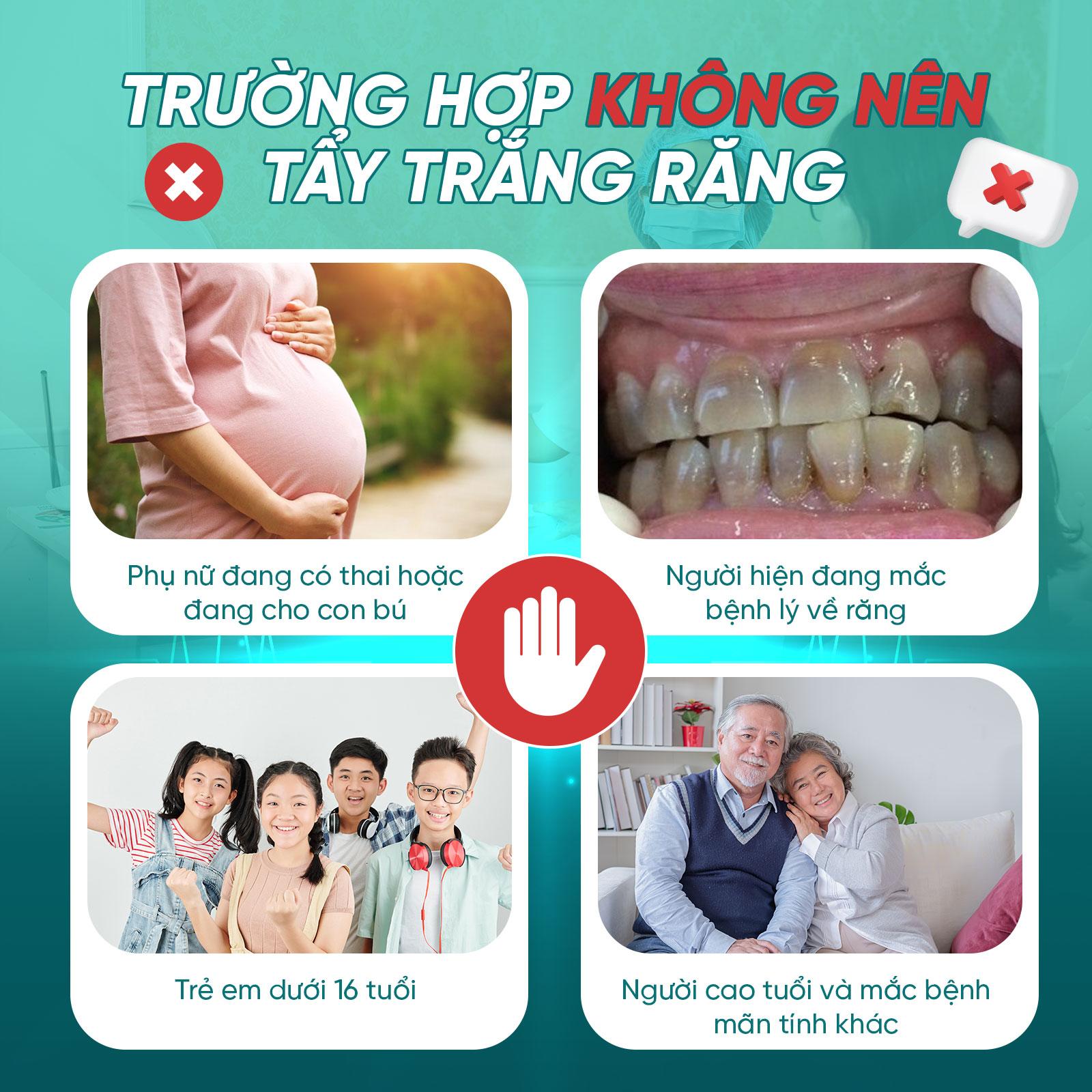 Các trường hợp nên tẩy trắng răng