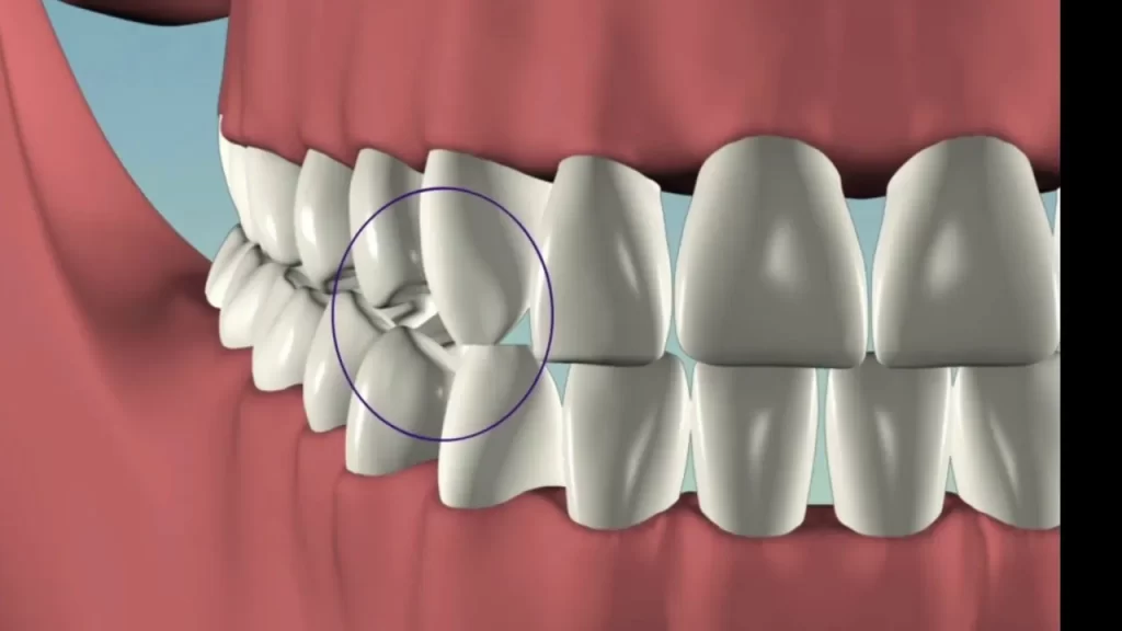Răng nanh có hình dáng sắc nhọn và cạnh nhọn, giúp chúng hoàn hảo cho việc cắt và xé thức ăn
